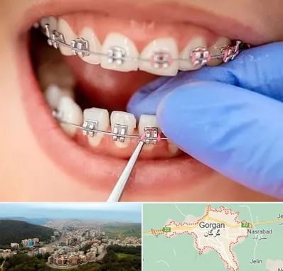 مرکز ارتودنسی دندان در گرگان