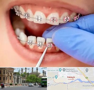 مرکز ارتودنسی دندان در پاکدشت