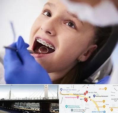 دکتر ارتودنسی کودکان در پارک وی