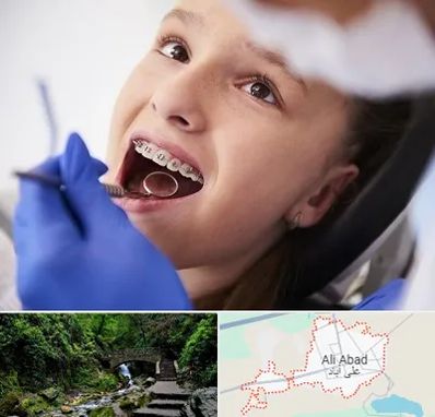 دکتر ارتودنسی کودکان در علی آباد کتول