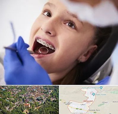 دکتر ارتودنسی کودکان در دماوند