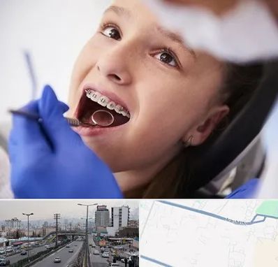 دکتر ارتودنسی کودکان در بلوار ارتش