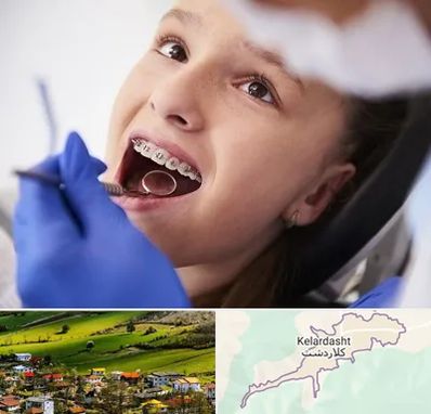دکتر ارتودنسی کودکان در کلاردشت
