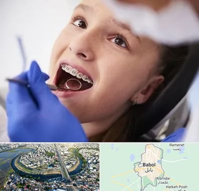 دکتر ارتودنسی کودکان در بابل