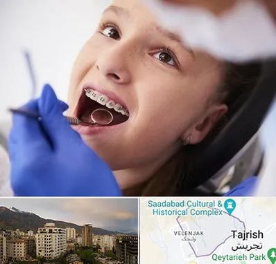 دکتر ارتودنسی کودکان در زعفرانیه