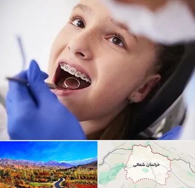 دکتر ارتودنسی کودکان در خراسان شمالی