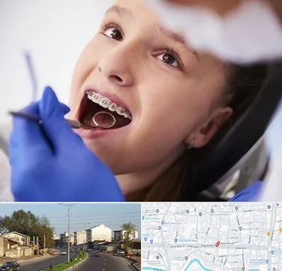 دکتر ارتودنسی کودکان در ضیابری رشت