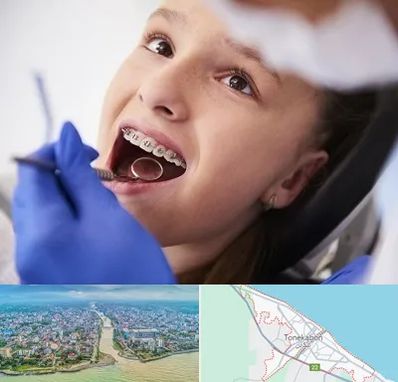 دکتر ارتودنسی کودکان در تنکابن