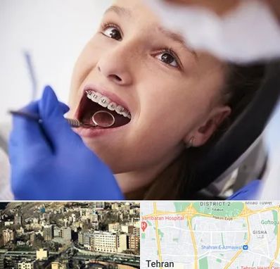 دکتر ارتودنسی کودکان در مرزداران
