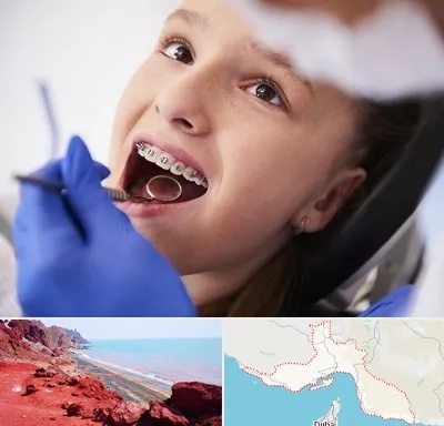 دکتر ارتودنسی کودکان در هرمزگان
