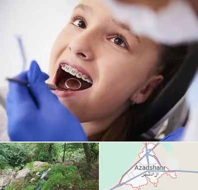 دکتر ارتودنسی کودکان در آزادشهر