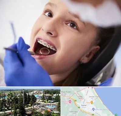 دکتر ارتودنسی کودکان در رودسر