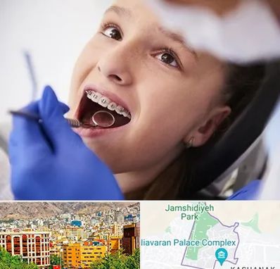 دکتر ارتودنسی کودکان در نیاوران