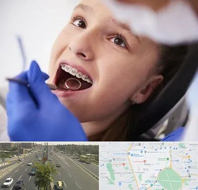 دکتر ارتودنسی کودکان در منطقه 17 تهران