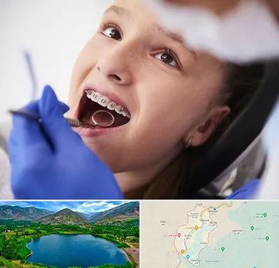 دکتر ارتودنسی کودکان در رودبار