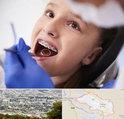 دکتر ارتودنسی کودکان در یاسوج
