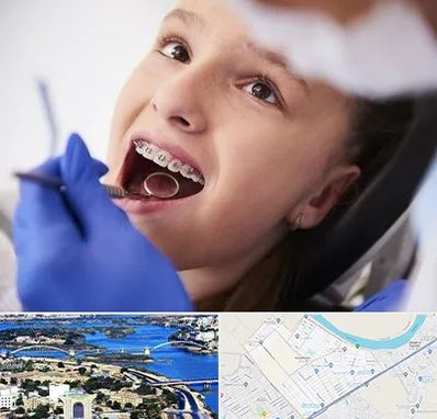 دکتر ارتودنسی کودکان در کوروش اهواز