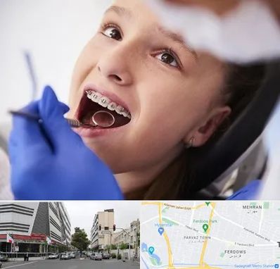 دکتر ارتودنسی کودکان در بلوار فردوس
