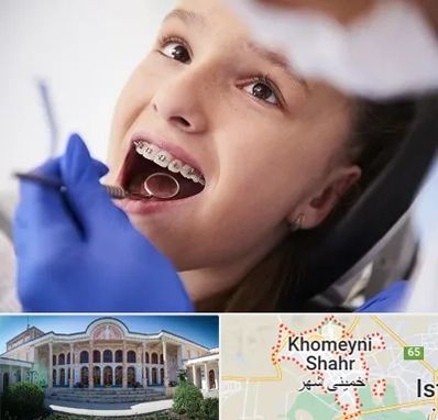 دکتر ارتودنسی کودکان در خمینی شهر