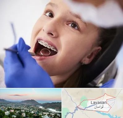 دکتر ارتودنسی کودکان در لواسان