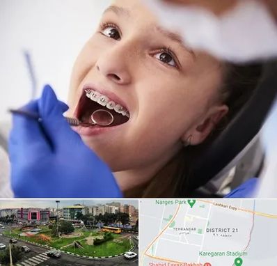دکتر ارتودنسی کودکان در تهرانسر