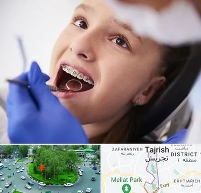 دکتر ارتودنسی کودکان در تجریش