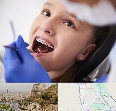 دکتر ارتودنسی کودکان در فرهنگ شهر شیراز