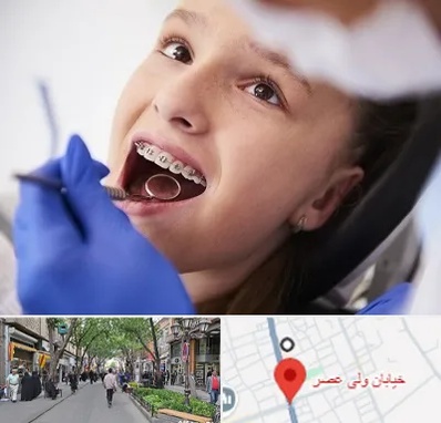 دکتر ارتودنسی کودکان در ولیعصر شهریار