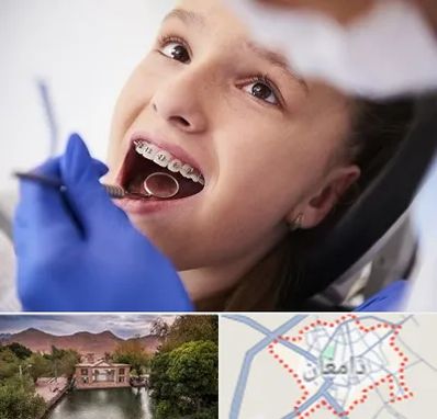 دکتر ارتودنسی کودکان در دامغان