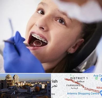 دکتر ارتودنسی کودکان در فرمانیه