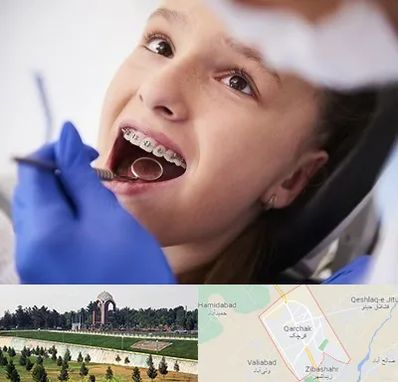 دکتر ارتودنسی کودکان در قرچک