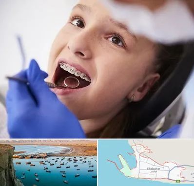 دکتر ارتودنسی کودکان در چابهار