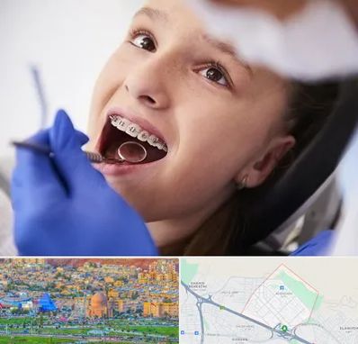 دکتر ارتودنسی کودکان در رشدیه تبریز