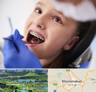 دکتر ارتودنسی کودکان در خرم آباد