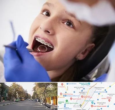 دکتر ارتودنسی کودکان در شریعتی