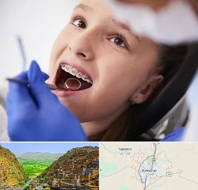 دکتر ارتودنسی کودکان در کامیاران