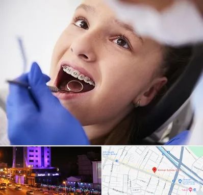 دکتر ارتودنسی کودکان در آبرسان تبریز