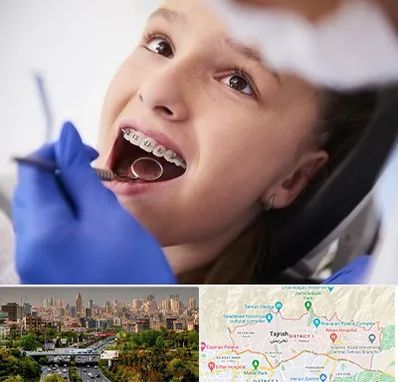 دکتر ارتودنسی کودکان در منطقه 1 تهران