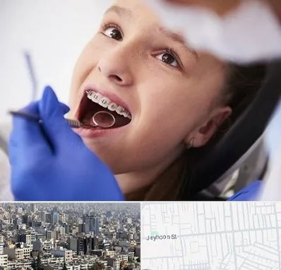 دکتر ارتودنسی کودکان در جیحون