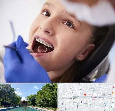 دکتر ارتودنسی کودکان در هشت بهشت اصفهان