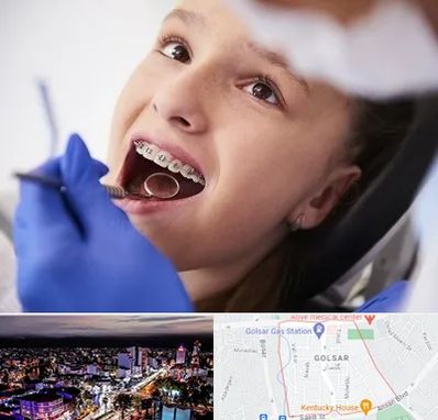 دکتر ارتودنسی کودکان در گلسار رشت