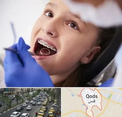 دکتر ارتودنسی کودکان در شهر قدس