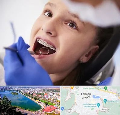 دکتر ارتودنسی کودکان در لاهیجان