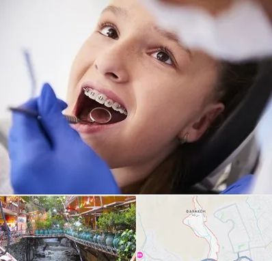 دکتر ارتودنسی کودکان در درکه