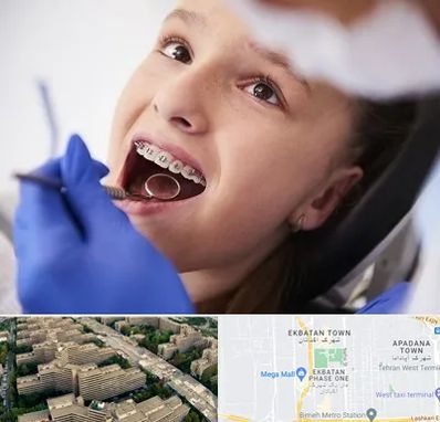 دکتر ارتودنسی کودکان در اکباتان