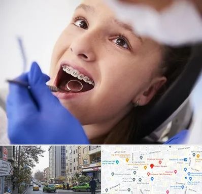 دکتر ارتودنسی کودکان در فاطمی