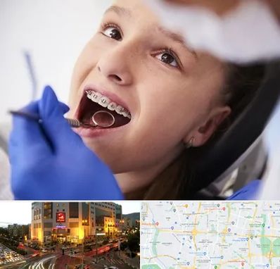 دکتر ارتودنسی کودکان در جنت آباد تهران