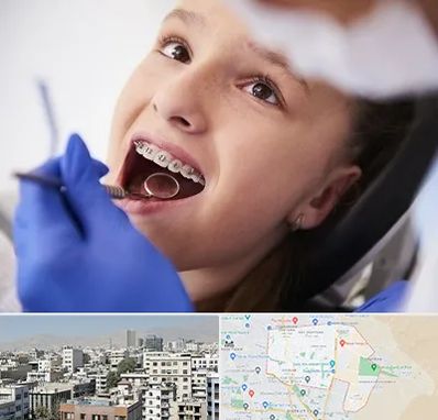 دکتر ارتودنسی کودکان در منطقه 14 تهران
