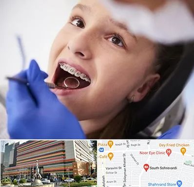 دکتر ارتودنسی کودکان در سهروردی