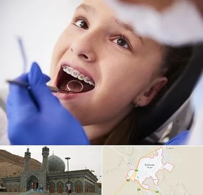 دکتر ارتودنسی کودکان در شهرضا